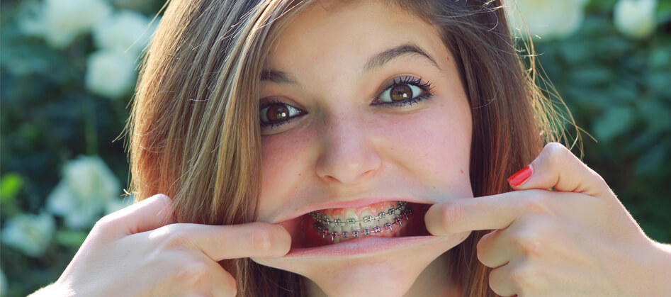 Girl With Braces